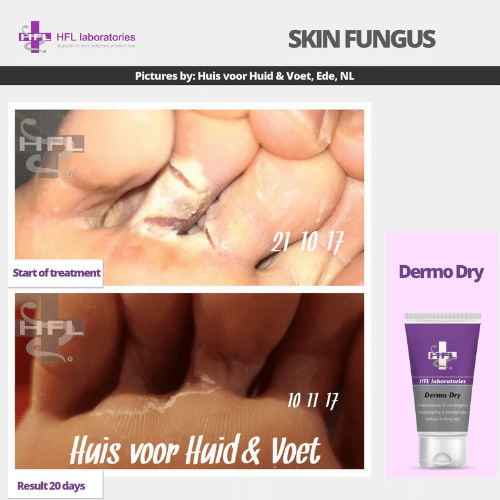 Dermo_Dry-_HFL_Laboratories_2