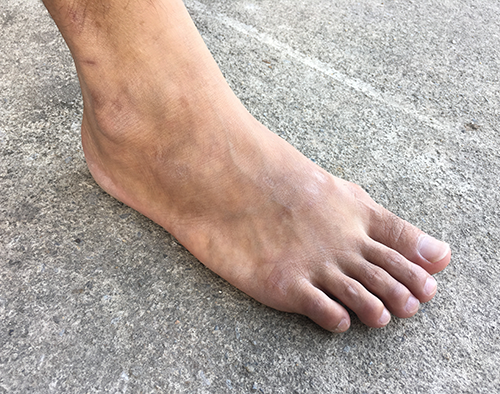 Wintervoeten & winterhanden