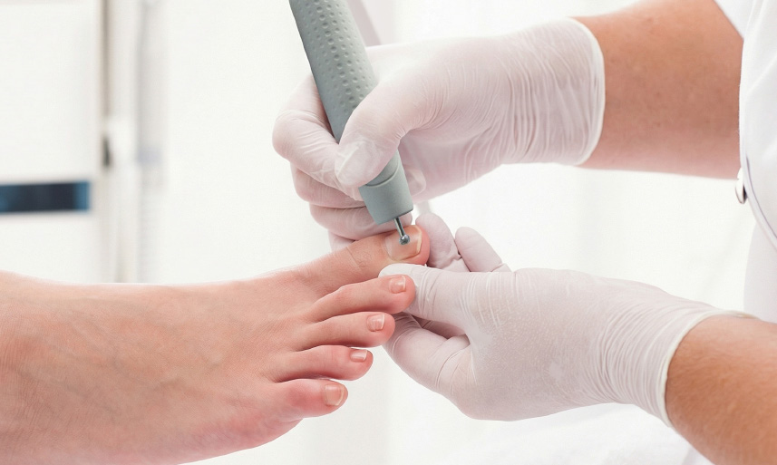 Pedicurebehandeling met een SÜDA freestoestel met nattechniek